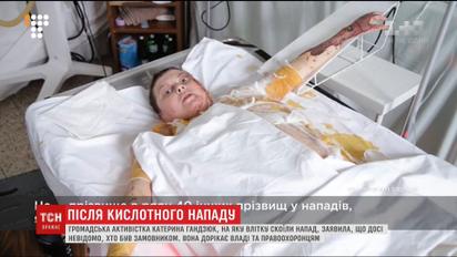 Облитая кислотой активистка Екатерина Гандзюк записала видеообращение