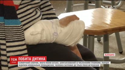 Нетверезий батько відлупцював 7-річного сина до струсу мозку та переломів