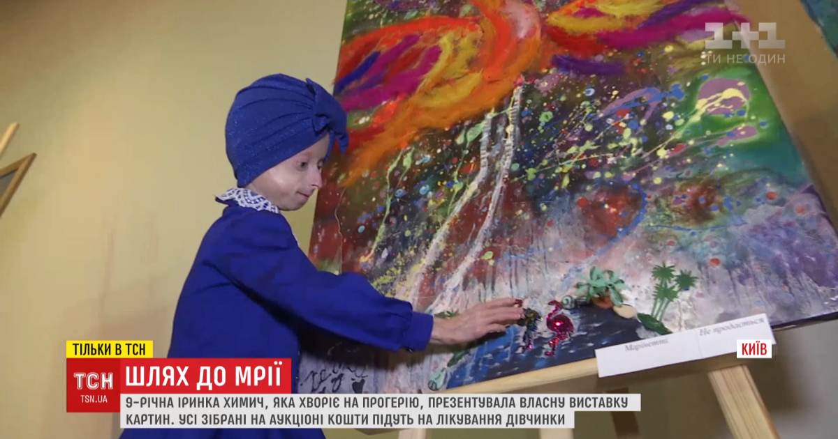 В Киеве 9-летняя винничанка с синдромом преждевременного старения представила собственную выставку картин