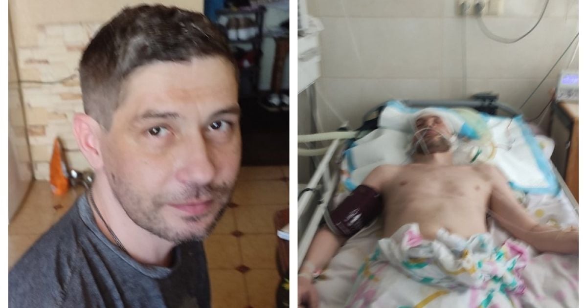 Андрій Панасюк до відвідин ТЦК (ліворуч) і в лікарні після візиту (праворуч)