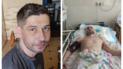 Андрій Панасюк до відвідин ТЦК (зліва) і в лікарні після візиту (справа)