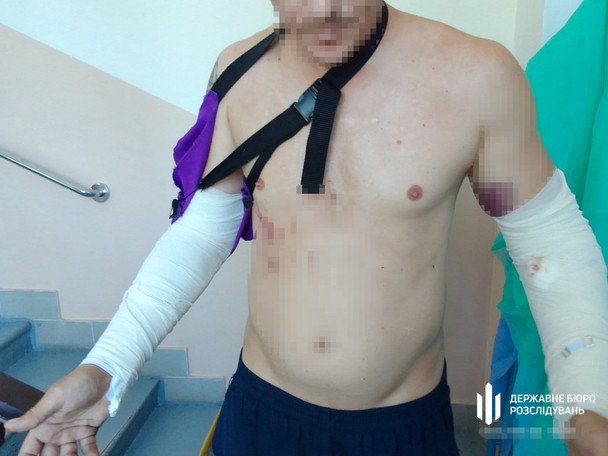 В Кировоградской области офицер ВСУ жестоко избил новобранца во время учений (фото)