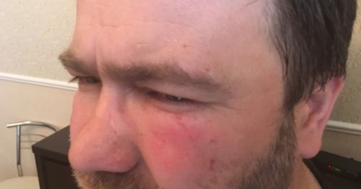Полиция возбудила дело из-за очередного конфликта между Парасюком и журналистом "Дорожного контроля"