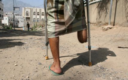 Врач из Украины в Йемене ради денег направил на ненужную ампутацию десятки людей: подробности шокирующего дела