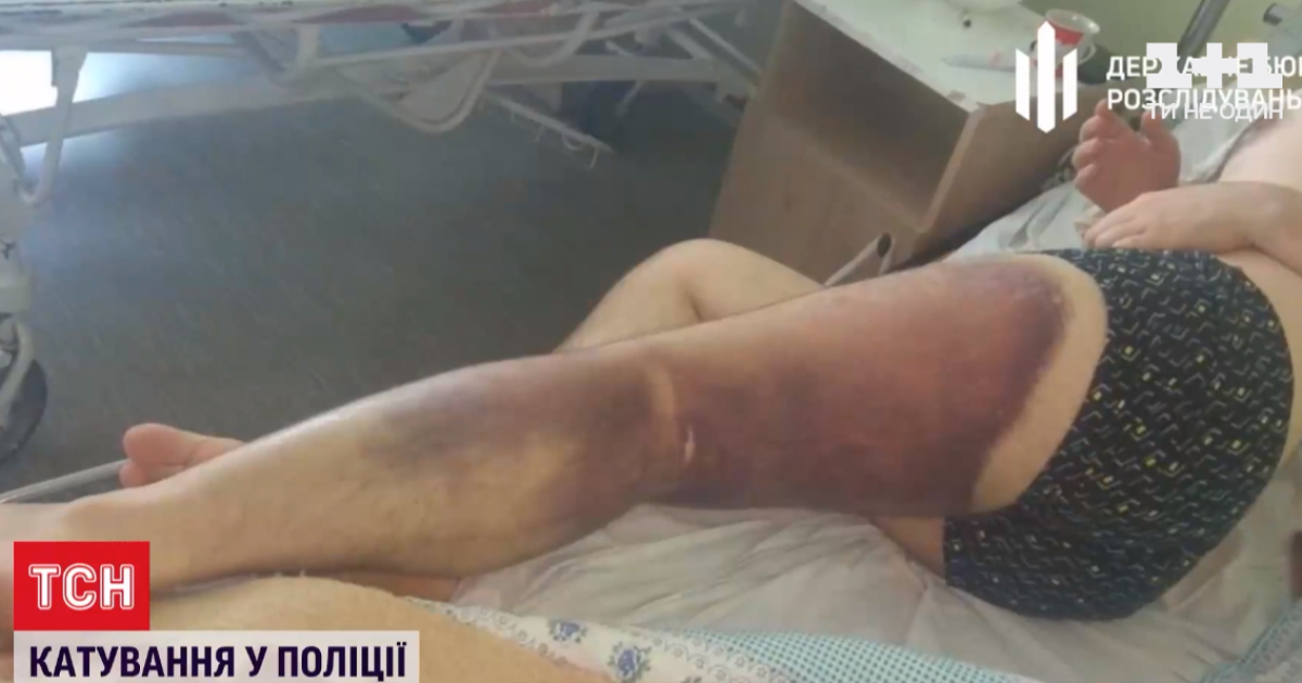 Избиения, издевательства и изнасилования: ТСН вспомнила резонансные истории полицейского произвола