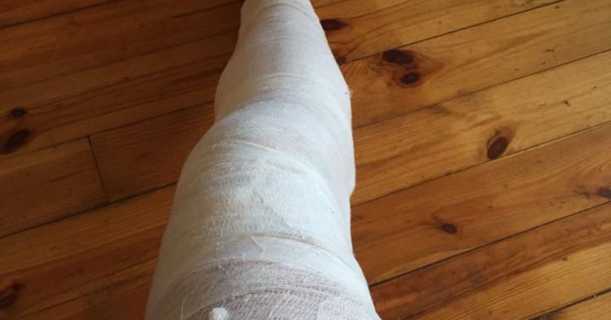 аварія авто Ігоря Швайки_4 / © facebook/Ігор Швайка