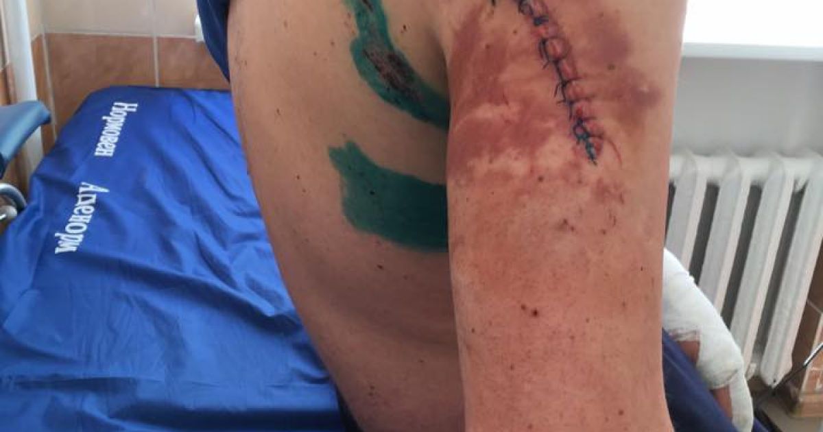 аварія авто Ігоря Швайки_6 / © facebook/Ігор Швайка