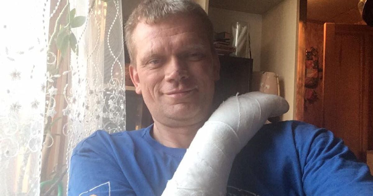 аварія авто Ігоря Швайки_5 / © facebook/Ігор Швайка