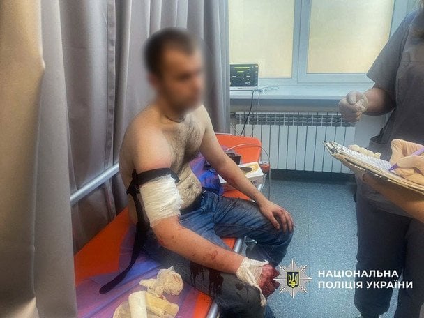 Троє правоохоронців отримали ножові поранення. / © Національна поліція України
