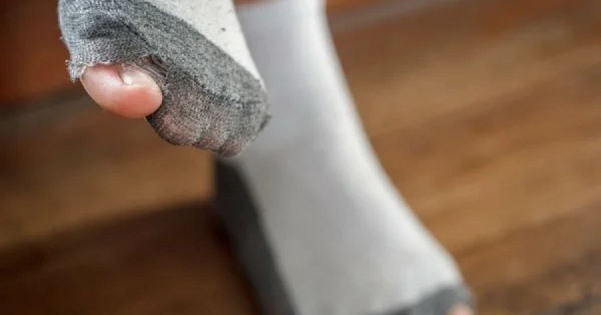 Чому не можна носити діряві шкарпетки