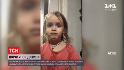 Критические ожоги: днепровские медики борются за жизнь трехлетней девочки