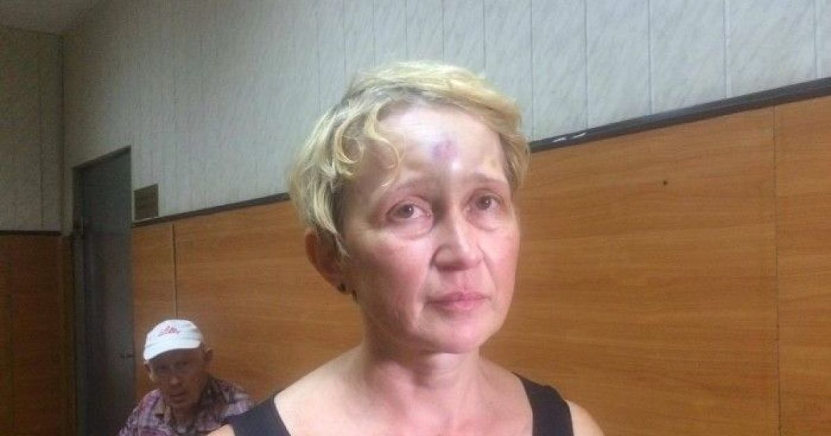 В Одессе неизвестные избили участницу экспертной комиссии Группы 2 мая