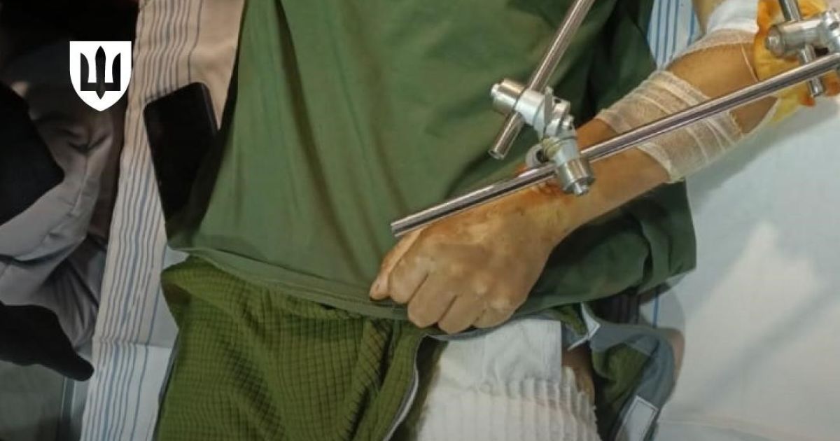 Военные получат специальную одежду для раненых