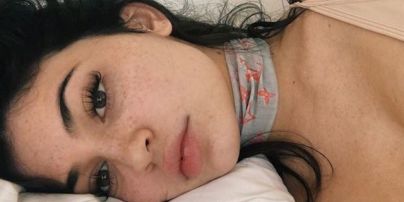 Младшая сестра Кардашян напугала прыщавым лицом без макияжа