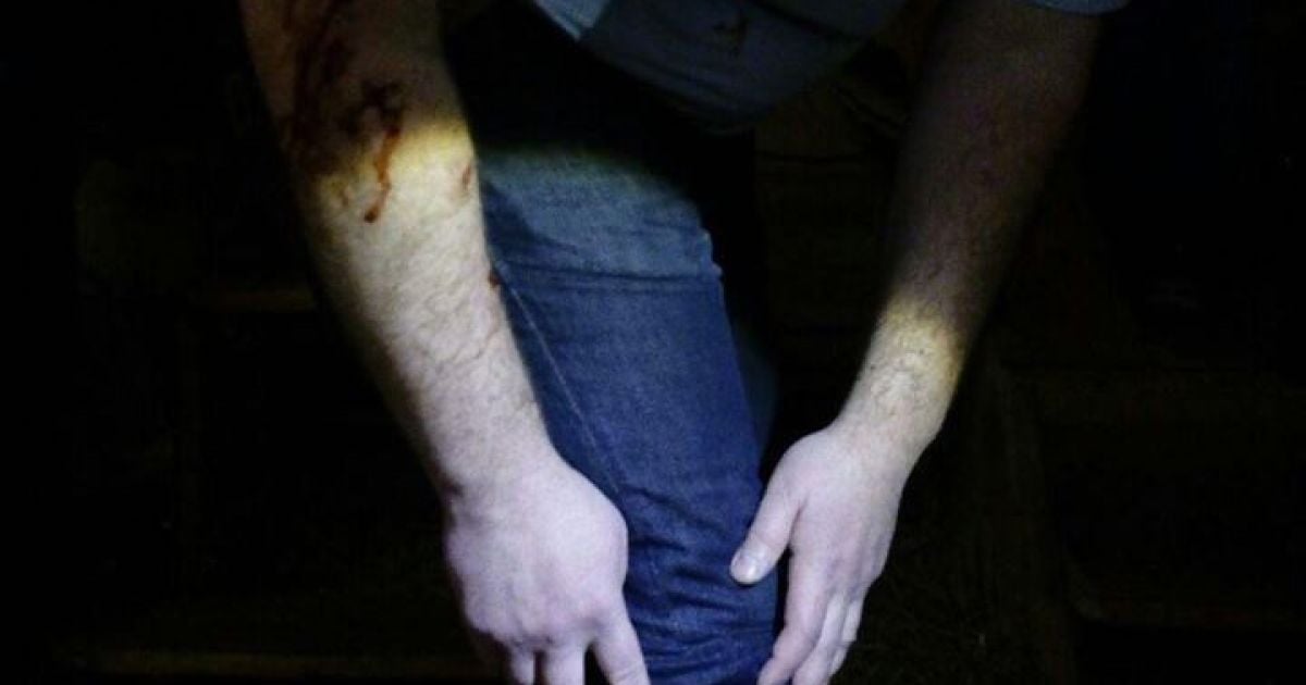 У Запоріжжі на чоловіка в лазні напав лев_1 / © 061.ua