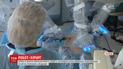 Перша в Україні операція робота-хірурга відбулась у Вінниці