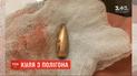 Поранення підлітка на полігоні у Дніпрі: понад 2 місяці слідство не може встановити винних