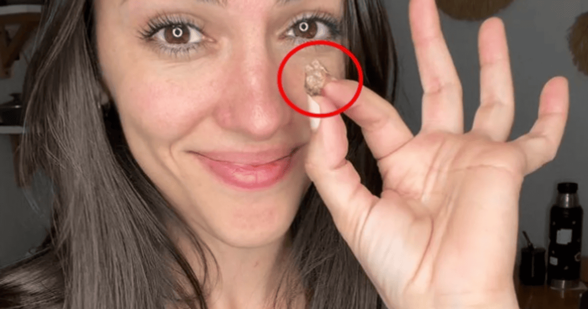 У женщины нашли ленту в носу