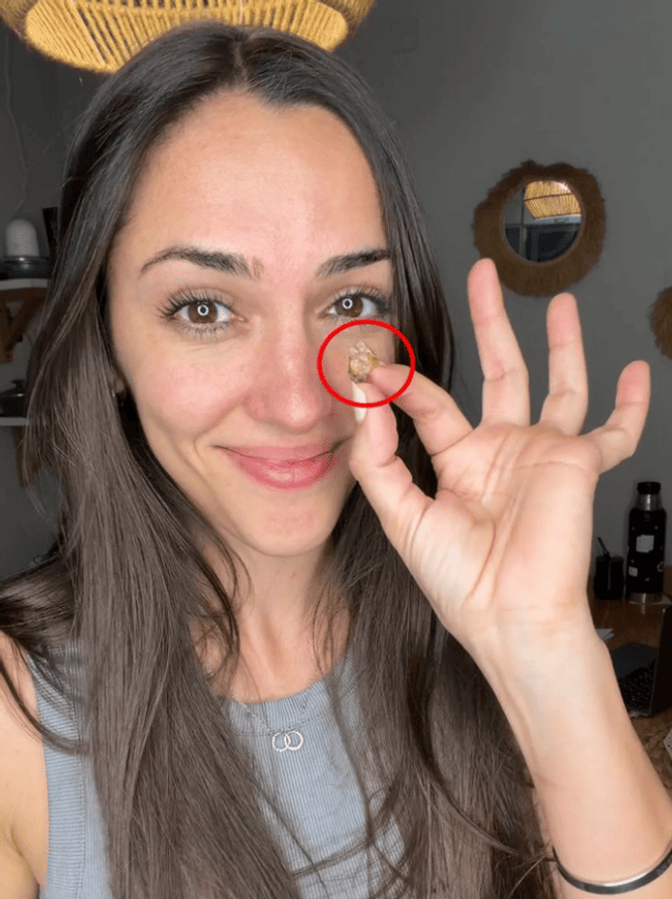 Могла остаться еще с роддома: в носу женщины обнаружили неожиданную находку