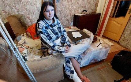 "Очень было больно. Обувь была разорвана": женщина, которой троллейбус переехал ногу в Николаеве, рассказала детали