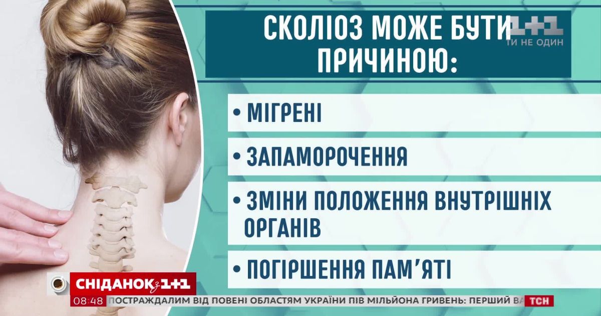 Как распознать сколиоз и что делать для профилактики нарушений развития позвоночника у детей и подростков