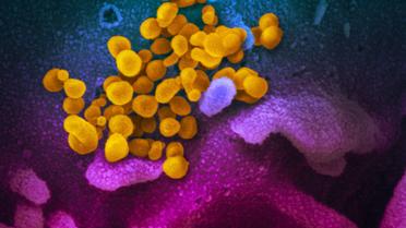 Китайський коронавірус під мікроскопом_4 / © Flickr / National Institute of Allergy and Infectious Diseases