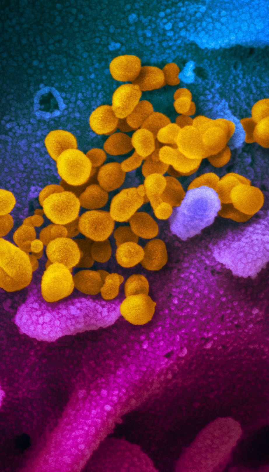 "Это спекуляция": ВОЗ отреагировала на заявления Трампа относительно лабораторного происхождения коронавируса