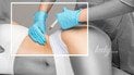 "Зомбі філери": трупний донорський жир набирає більшої популярності, а лікарі бʼють на сполох