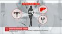 Неприятие подростками своего тела все чаще приводит к попыткам суицида