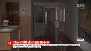 Сиамские близнецы, рожденные в Черновцах, - до сих пор в тяжелом состоянии