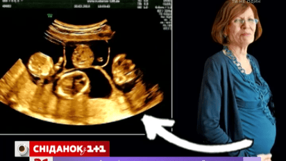 Українські репродуктологи допомогли завагітніти 65-річній німкені четвернею