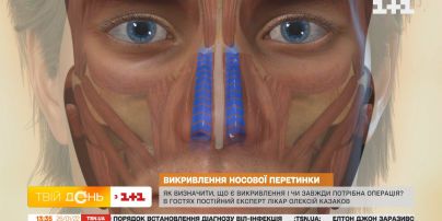 Искривление носовой перегородки: как распознать и всегда ли нужна операция