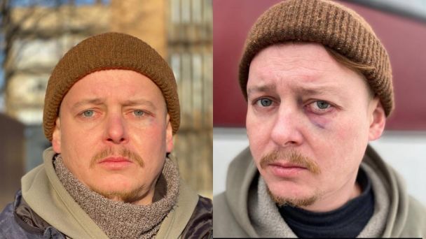 Актор Микола Лемешко / © facebook.com/ChernihivTheatre