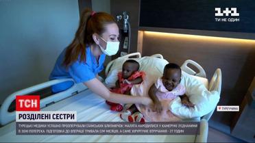 Новини світу: турецькі медики успішно прооперували сіамських близнючок