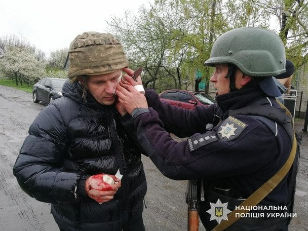 Чоловік кинув гранату у поліціянтів: є багато поранених