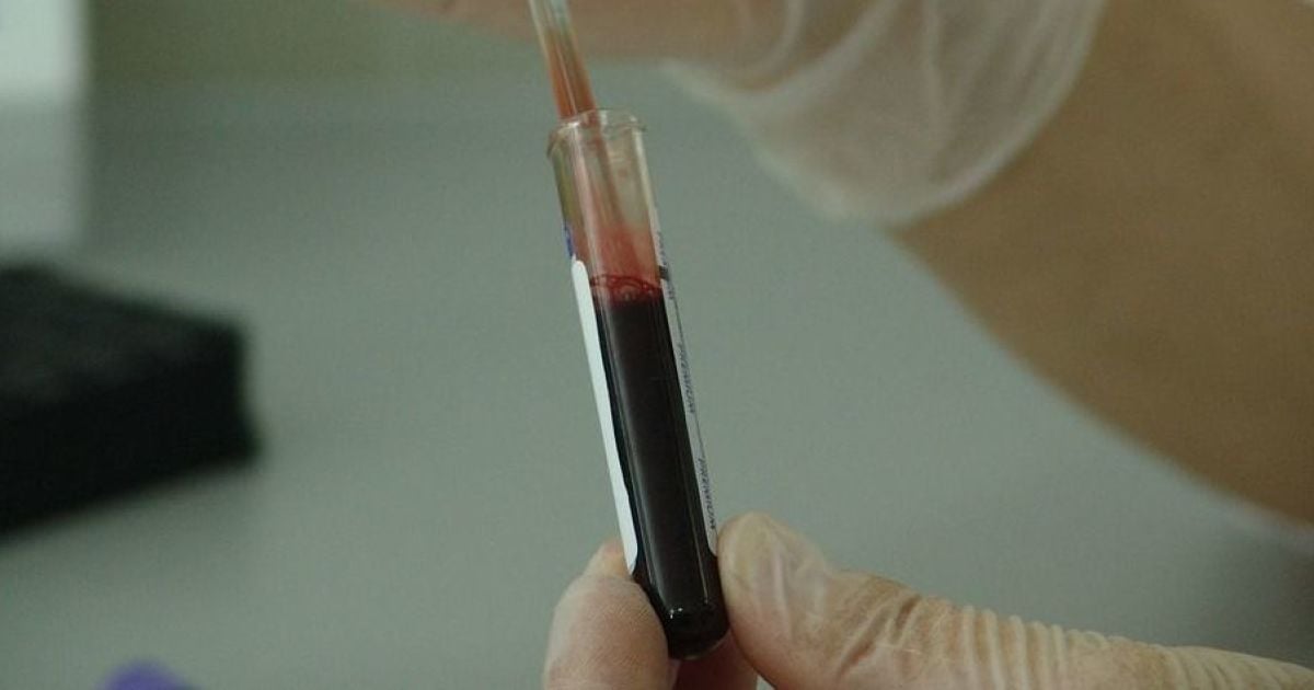 Унікальний випадок: в Іспанії жінка хворіла на рак 12 разів