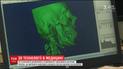 Технологии 3D-печати в медицине. Как на специальных принтерах изготавливают части лица