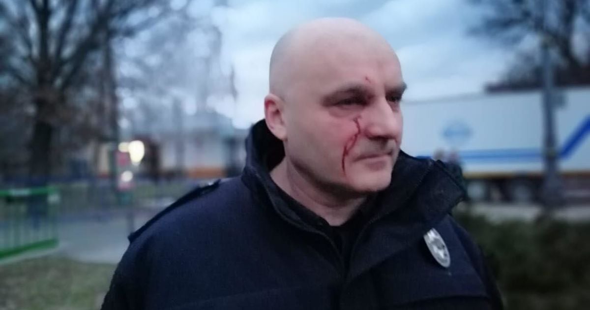 Сутички із "Нацдружинами" в Черкасах: до медиків звернулися 22 правоохоронці, 19 з них – госпіталізовано