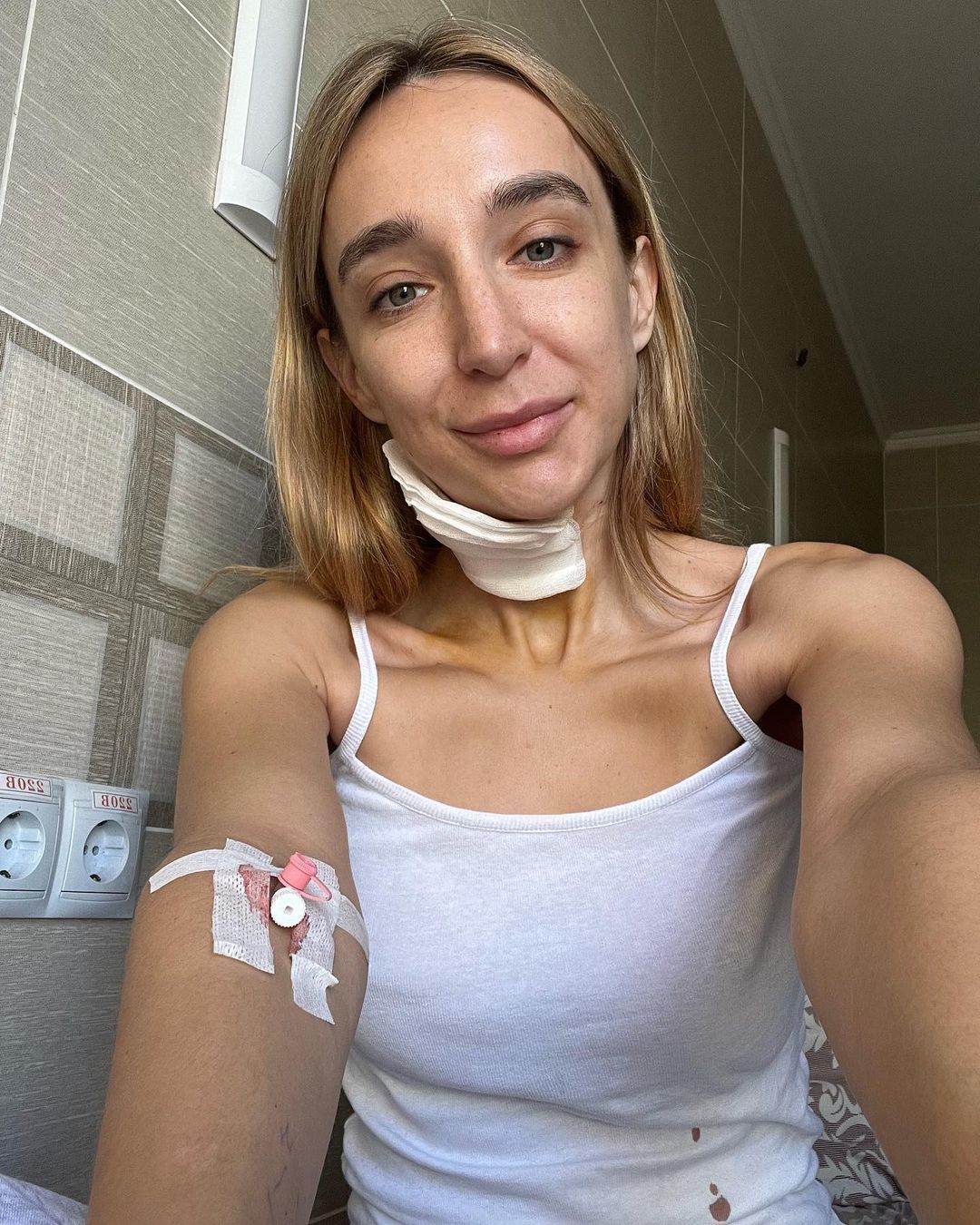 Елене Мандзюк удалили опухоль / © instagram.com/elena_mandziuk