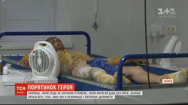 За життя юнака, який врятував свого дідуся під час пожежі, борються харківські лікарі