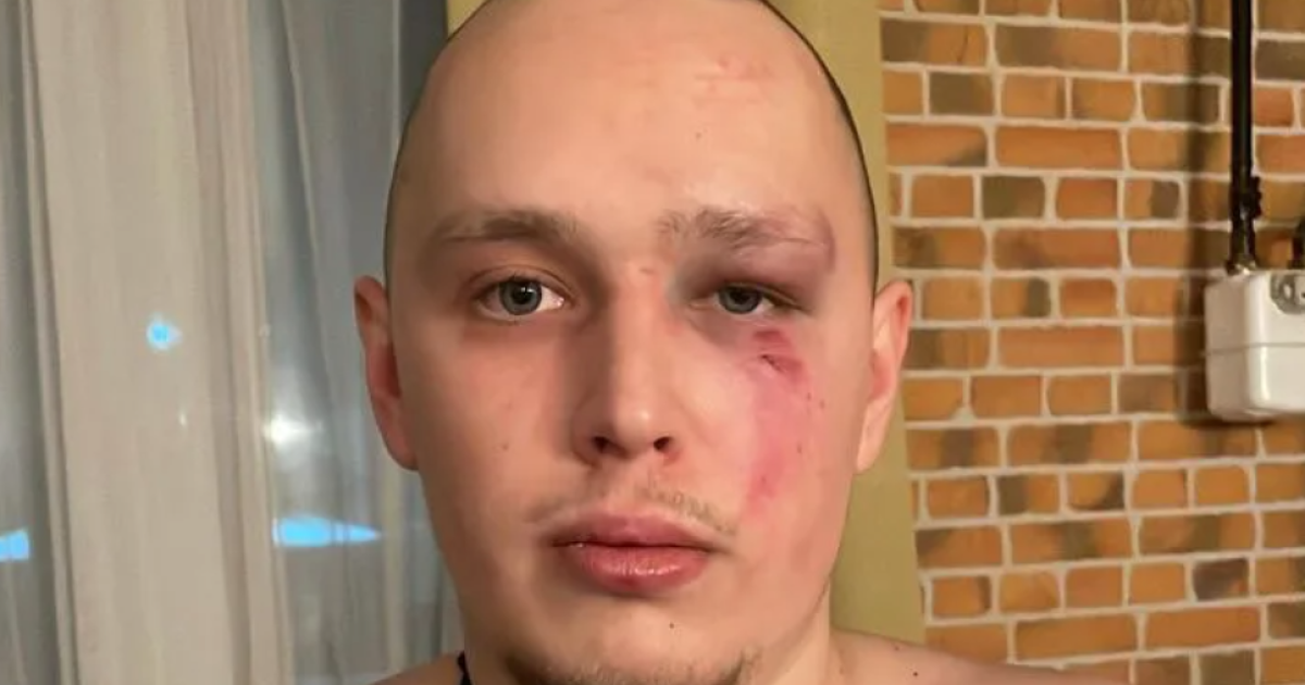 Алексей Иванин, которого избили охранники больницы в Киевской области