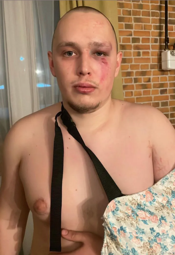 Алексей Иванин, которого избили охранники больницы в Киевской области / © 24 канал