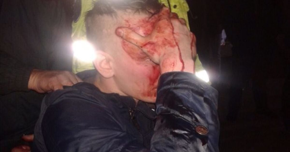 Российские болельщики подрались в Кишиневе.