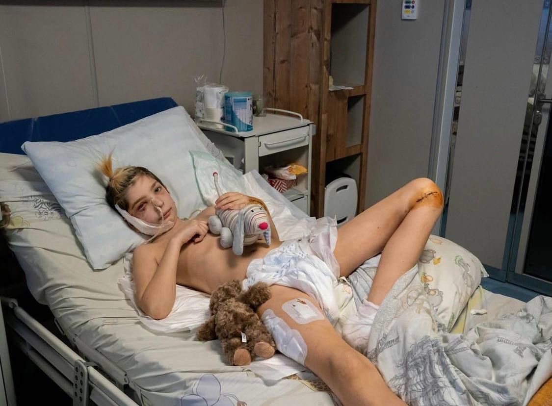 13-річний Вова, який потрапив під обстріл у Києві / © НДСЛ 