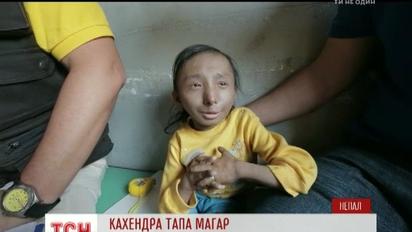 Программа "Мир наизнанку" пытается спасти рекорд самого маленького мужчины в мире
