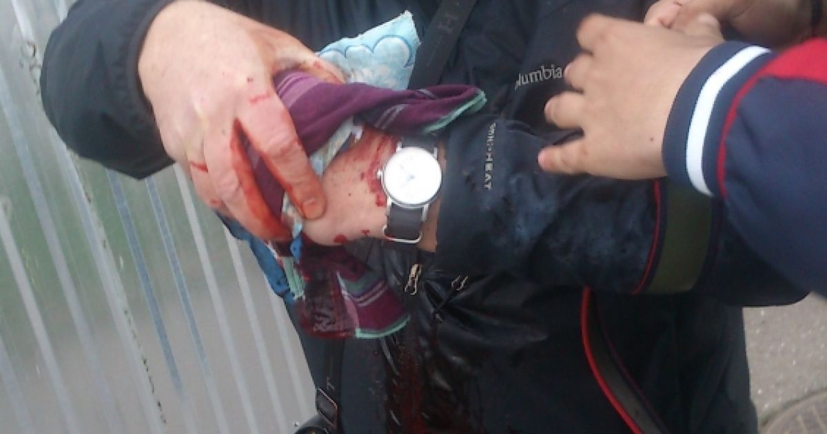 В Одессе на пророссийском митинге прогремел взрыв