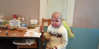 Украинцы за месяц собрали 6 млн гривен на лечение больной Лизы