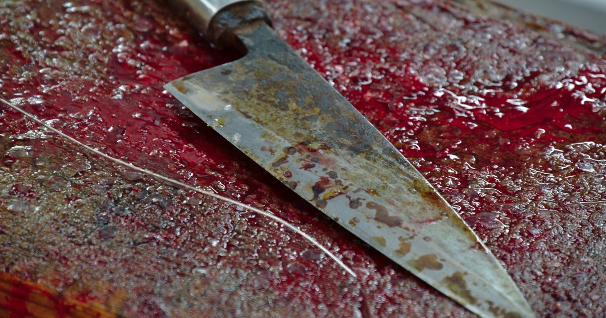 В Киеве произошло кровавое нападение на продуктовый магазин: продавщица получила многочисленные травмы
