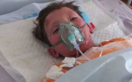 "Мамулічка, дай слово, що я не помру": на Кіровоградщині рятують 10-річного хлопчика, який обгорів