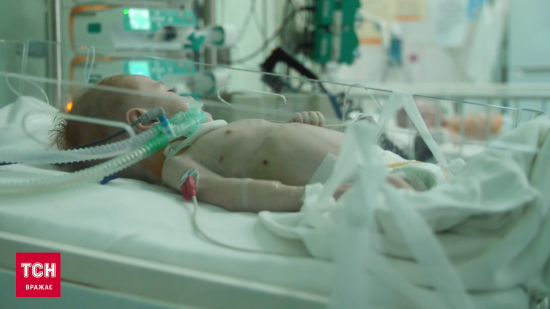 У родині хлопчика із поліомієлітом ще у шістьох дітей виявили вірус: малюк вже не стає на ноги
